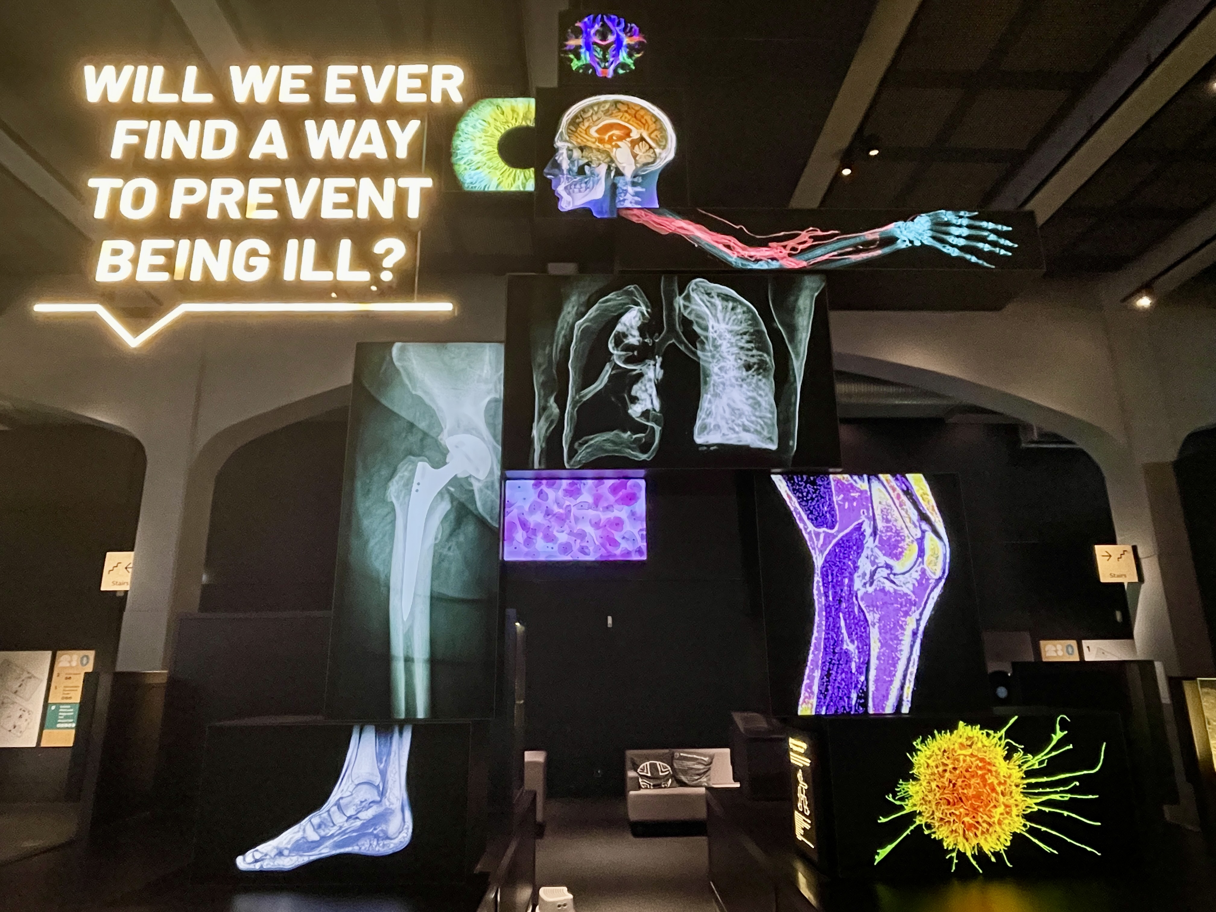 Will We Ever Find a Way to Prevent Being Ill display with medical imaging screens at We The Curious Bristol